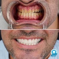 Slider image (3) Turkiye Dental
